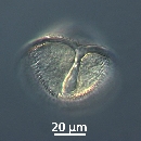 Protoperidinium subinerme