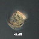 Protoperidinium subinerme