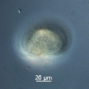 Protoperidinium subinerme