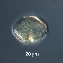 Protoperidinium subinerme