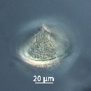 Protoperidinium subinerme