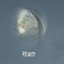 Protoperidinium subinerme