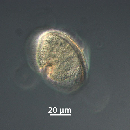 Protoperidinium subinerme