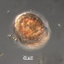 Protoperidinium thorianum