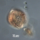 Protoperidinium thorianum