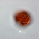 Protoperidinium thorianum