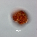 Protoperidinium thorianum