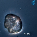 Protoperidinium obtusum