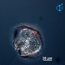 Protoperidinium obtusum