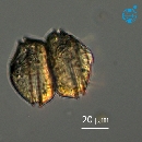 Protoperidinium denticulatum
