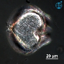 Protoperidinium obtusum