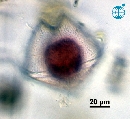 Protoperidinium obtusum