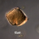 Protoperidinium subinerme