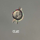 Protoperidinium steinii