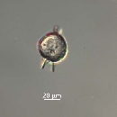 Protoperidinium steinii