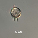 Protoperidinium steinii