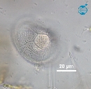 Protoperidinium subinerme