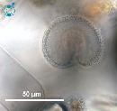 Protoperidinium subinerme