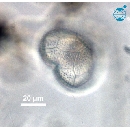 Protoperidinium subinerme