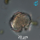 Protoperidinium obtusum