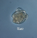 Ptychodiscus noctiluca