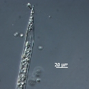 Rhizosolenia hebetata f semispina