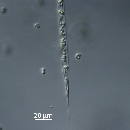 Rhizosolenia hebetata f semispina