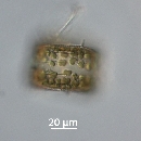 Thalassiosira hendeyi