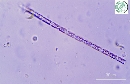 Limnothrix rosea