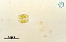 Cosmarium depressum var planctonicum