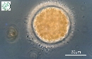 Microcystis wesenbergii