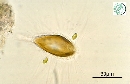 Mallomonas caudata