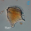 Dinophysis rapa