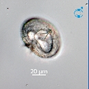 Protoperidinium ovatum