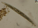 Closterium acerosum