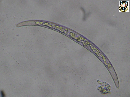 Closterium dianae