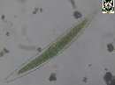 Closterium lanceolatum