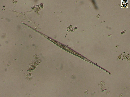 Closterium setaceum