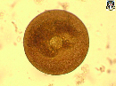 Arcella vulgaris