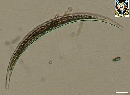 Closterium dianae var minus