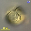 Protoperidinium steinii