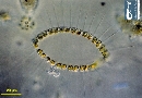 Chaetoceros curvisetus