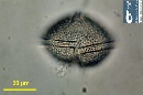 Protoperidinium ovatum