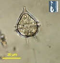 Protoperidinium steinii