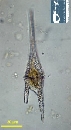 Neoceratium furca