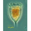 Acanthostomella conicoides