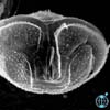 Protoperidinium subinerme