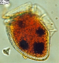 Dinophysis norvegica