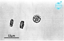 Thalassiosira hyalina