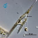 Neoceratium furca